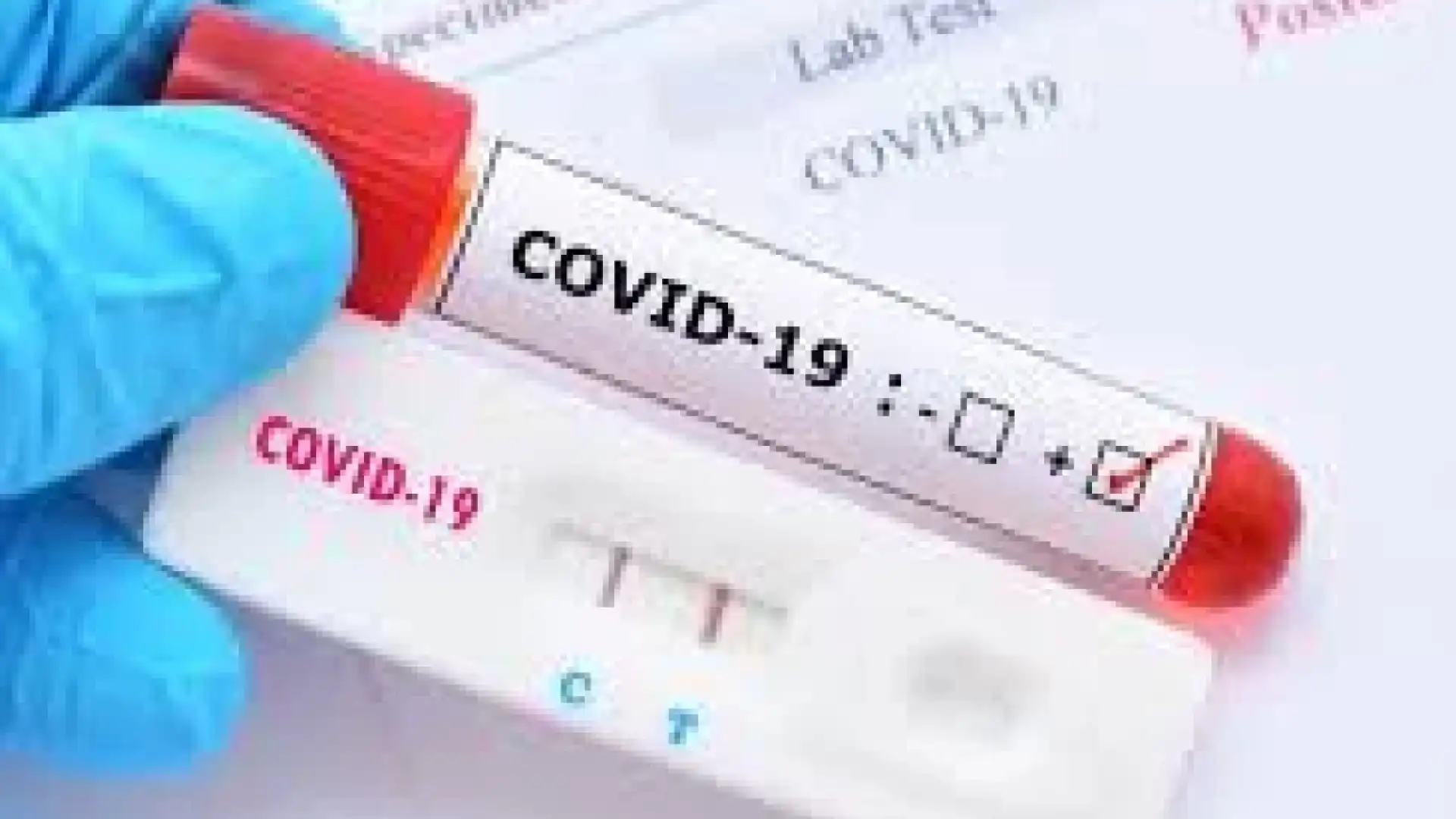 Covid in Molise: 20 i positivi in Regione nelle ultime 48 ore. Sono 76 le persone che hanno superato il Virus. Scarica il bollettino Asrem